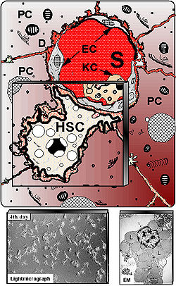 Wikipedia Grafik von einer Hepatic stellate cell, HSC, Lipocyte, Leberzelle